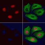 Phospho-GATA1 (Ser310) Polyclonal Antibody