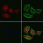 Phospho-Smad3 (Ser208) Polyclonal Antibody