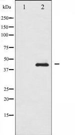 Phospho-Smad3 (Ser208) Antibody in Western Blot (WB)