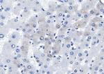 BMP-5 Polyclonal Antibody