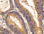 EFEMP2 Antibody in Immunohistochemistry (Paraffin) (IHC (P))