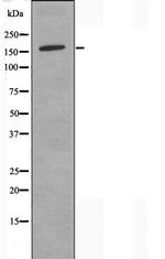 COL4A2 Antibody in Western Blot (WB)