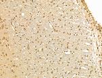 Cyclin A1 Antibody in Immunohistochemistry (Paraffin) (IHC (P))