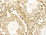 Cyclin A1 Antibody in Immunohistochemistry (Paraffin) (IHC (P))
