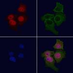 Bcr Polyclonal Antibody