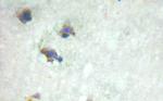 Bcr Antibody in Immunohistochemistry (Paraffin) (IHC (P))