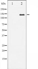 Bcr Antibody in Western Blot (WB)