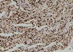 Phospho-SF1 (Ser80, Ser82) Polyclonal Antibody