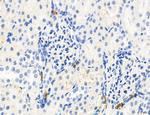 Phospho-MYL2 (Ser15) Antibody in Immunohistochemistry (Paraffin) (IHC (P))