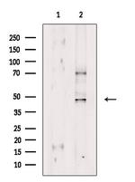 GPRIN2 Polyclonal Antibody