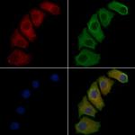 PLA1A Polyclonal Antibody