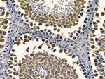 RAB11FIP4 Antibody in Immunohistochemistry (Paraffin) (IHC (P))