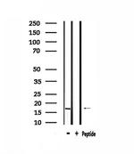 RPS13 Polyclonal Antibody