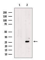 SCAND1 Polyclonal Antibody