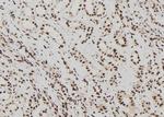 ELP2 Polyclonal Antibody