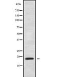 ZNF9 Polyclonal Antibody