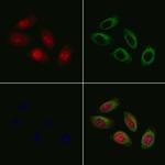 RTDR1 Polyclonal Antibody