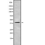 RTDR1 Antibody in Western Blot (WB)