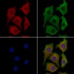 COX6A2 Polyclonal Antibody