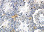 Cytokeratin 81/86 Polyclonal Antibody