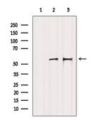 Cytokeratin 81/86 Antibody in Western Blot (WB)