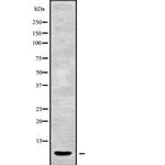 CYP21A2 Antibody in Western Blot (WB)