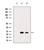 CDO1 Polyclonal Antibody