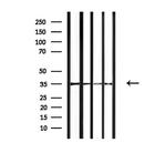OR4F15 Polyclonal Antibody