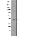 OR2B6 Polyclonal Antibody