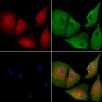 OR52R1 Polyclonal Antibody