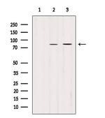 PLOD2 Polyclonal Antibody