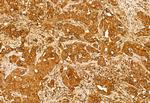 Centrin 1 Antibody in Immunohistochemistry (Paraffin) (IHC (P))