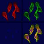 Centrin 1 Polyclonal Antibody