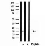 Centrin 1 Antibody in Western Blot (WB)