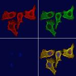 AP1M1 Polyclonal Antibody