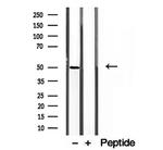 AP1M1 Antibody in Western Blot (WB)
