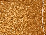 NOB1 Antibody in Immunohistochemistry (Paraffin) (IHC (P))