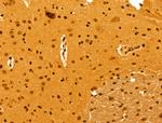NOB1 Antibody in Immunohistochemistry (Paraffin) (IHC (P))