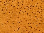 NOB1 Antibody in Immunohistochemistry (Paraffin) (IHC (P))
