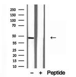 NOB1 Antibody in Western Blot (WB)