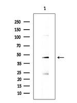 NOB1 Antibody in Western Blot (WB)