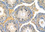 MEST Antibody in Immunohistochemistry (Paraffin) (IHC (P))