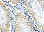 MEST Antibody in Immunohistochemistry (Paraffin) (IHC (P))