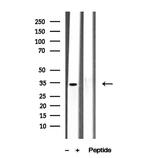 MEST Antibody in Western Blot (WB)