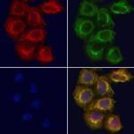 CXXC5 Polyclonal Antibody