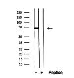 FAM65B Antibody in Western Blot (WB)