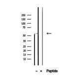 PDHX Antibody in Western Blot (WB)