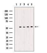 PDHX Antibody in Western Blot (WB)