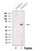 WHSC2 Polyclonal Antibody