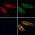 PDLIM3 Polyclonal Antibody